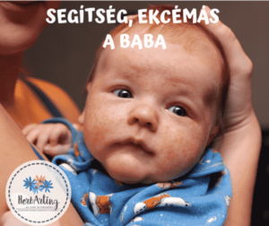 ekcémás baba